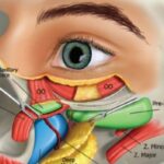 periorbital fats