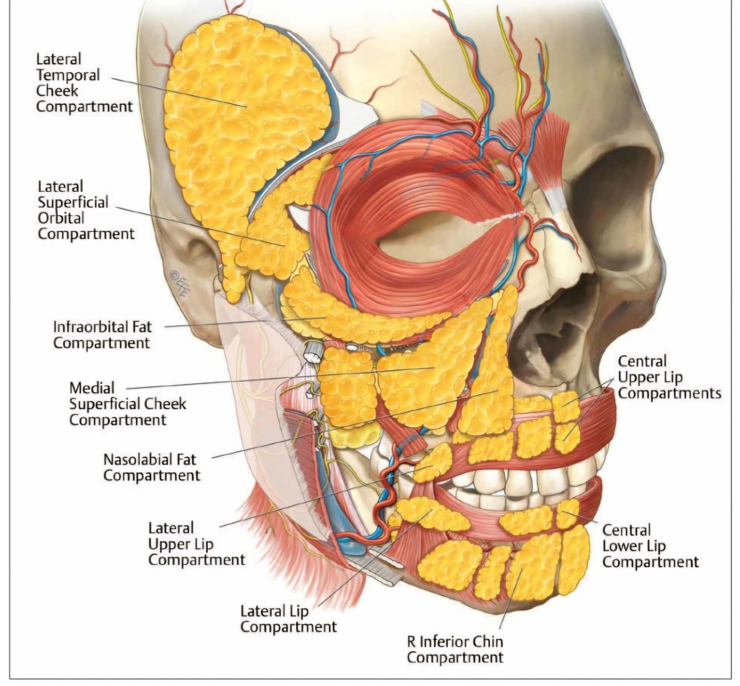 dermal fillers workshop