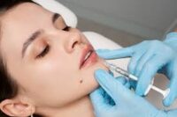 lip augmentation