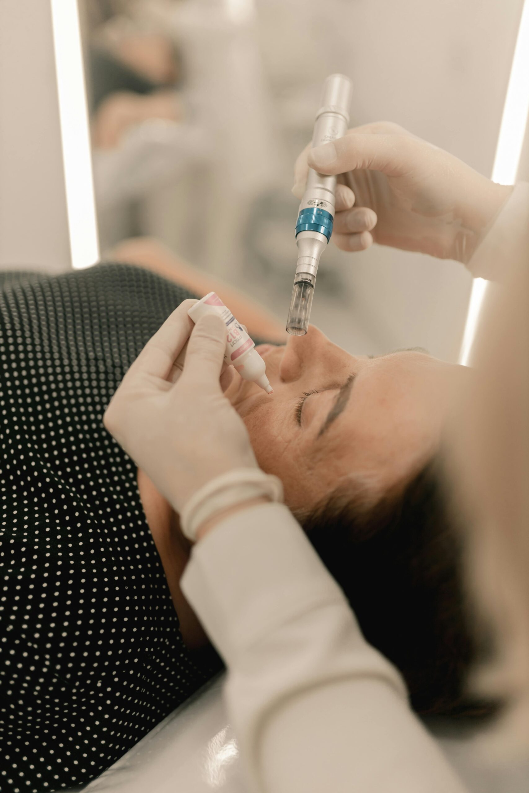 microneedling